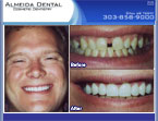 cosmetic dentist Colorado case study