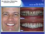 case study from cosmetic dentist Colorado