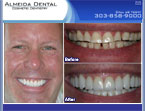 sample cosmetic dentist Colorado case study